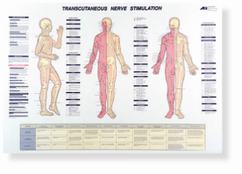 A poster of the human body with different areas.
